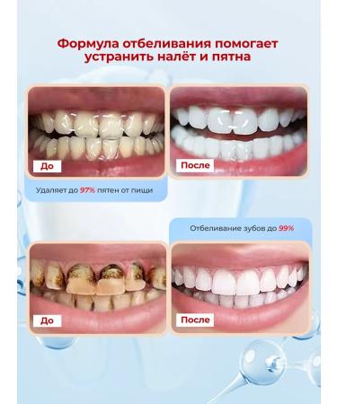 SP4 Whitening Toothpaste against Tartar and Plaque for Sensitive Teeth - Buy Online on GoSupps.com