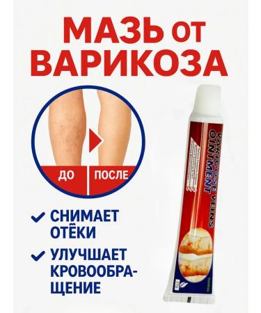 Ointment from varicose veins and vascular mesh with herbs