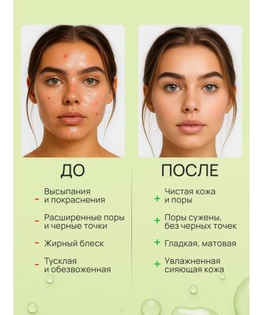 OIL'I Problem skin tonic - Buy Online on GoSupps.com