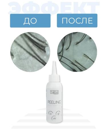 Tashe Set against the fat content of the scalp - Buy Online on GoSupps.com