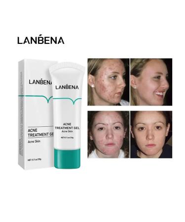 LANBENA From acne from acne patches and cream - Buy Online on GoSupps.com