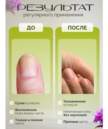 Vita Live Oil for the cuticle Extract of the monard and avocado 3pcs - Buy Online on GoSupps.com