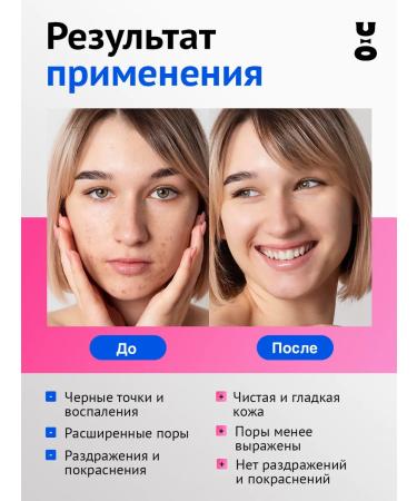 Cha U Kao Enzyme powder to combat acne Antiacne 80 g - Buy Online on GoSupps.com