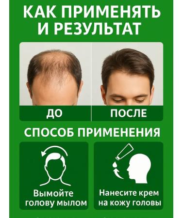 Catch something useful Soap from hair loss and ointment from seborrheic dermatitis - Buy Online on GoSupps.com
