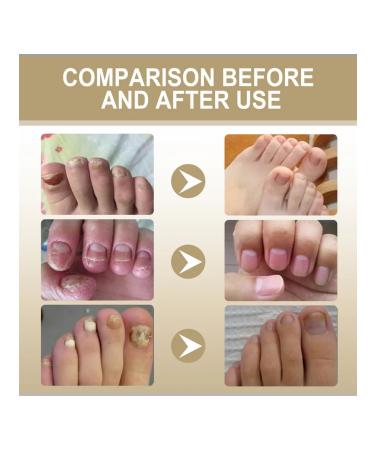 OUHOE SUSTERING WERE for Facial Pores - Buy Online on GoSupps.com