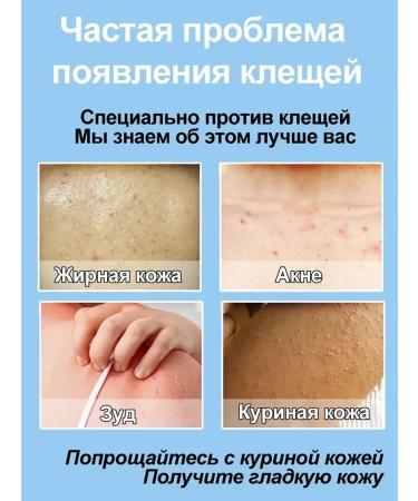 Shower gel from acne 300 ml skin cleansing - Buy Online on GoSupps.com