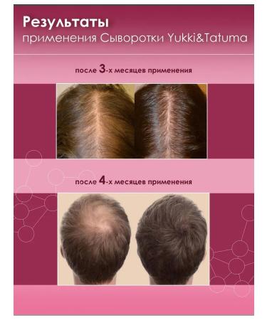 Yukki&Tatuma Hair growth with capxil against falling out - Buy Online on GoSupps.com