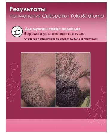 Yukki&Tatuma Hair growth with capxil against falling out - Buy Online on GoSupps.com