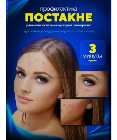 Yedatty Photoeper Professional laser - Buy Online on GoSupps.com