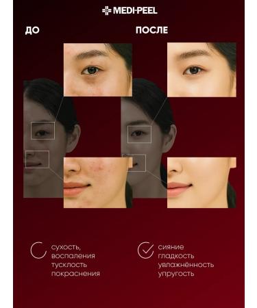 medi-peel Facial cream Peptide 9 Volume and Tension Tox Cream Pro - Buy Online on GoSupps.com