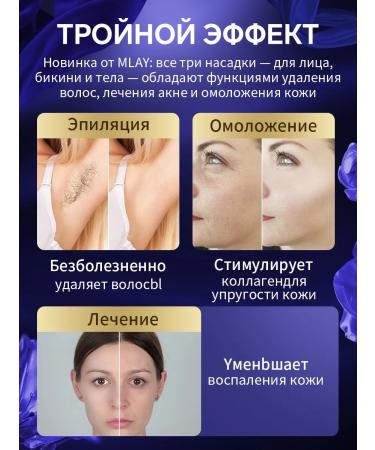 MLAY Effective IPL photoepalator for the whole body T14 +lamp*2 - Buy Online on GoSupps.com