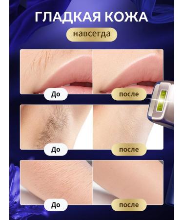 MLAY Effective IPL photoepalator for the whole body T14 +lamp*2 - Buy Online on GoSupps.com