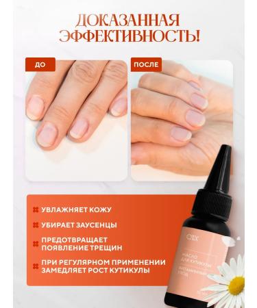 QTiX Oil for the cuticle is nutritious against dryness and burrs - Buy Online on GoSupps.com