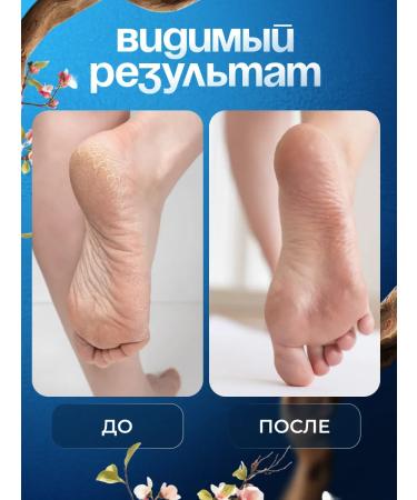 Goldenmine Pencil-kit for hands and legs against cracks - Buy Online on GoSupps.com