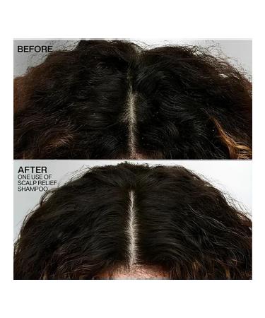 REDKEN Scalp Relief Shampoo control against dandruff 250 ml - Buy Online on GoSupps.com