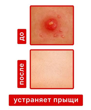 Dr Kirov / Dr Kirov Cosmetic Acne acne pointed a bee celandine - Buy Online on GoSupps.com
