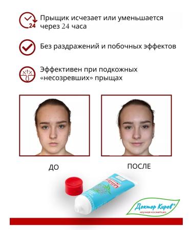 Dr Kirov / Dr Kirov Cosmetic Acne acne pointed a bee celandine - Buy Online on GoSupps.com