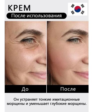 sadoer Face cream anti -aging set 2pcs - Buy Online on GoSupps.com