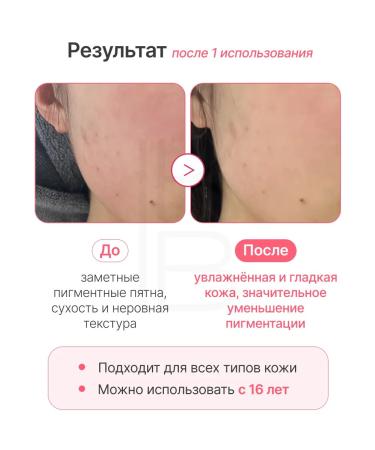 Medicube Toner-spades hydrogel - Buy Online on GoSupps.com