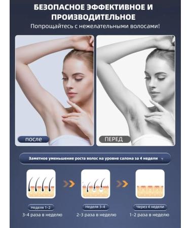 Laser photoeplator without pain 4 weeks - Buy Online on GoSupps.com