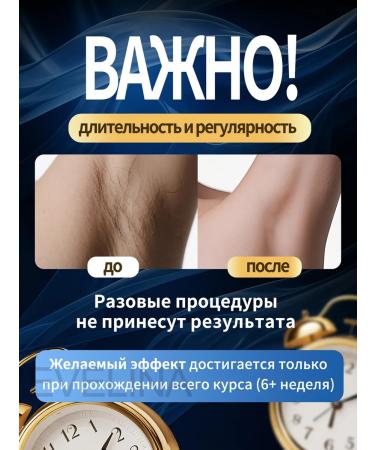 EVELINA PhotoPisher Laser Professional - Buy Online on GoSupps.com