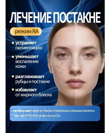 EVELINA PhotoPisher Laser Professional - Buy Online on GoSupps.com