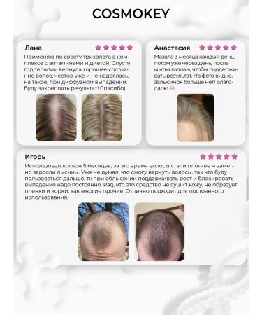 Cosmokey Tricapil 5% Soft Hair growth serum 50 ml - Buy Online on GoSupps.com