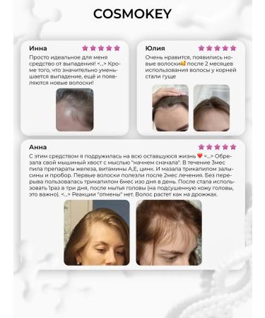 Cosmokey Tricapil 5% Soft Hair growth serum 50 ml - Buy Online on GoSupps.com