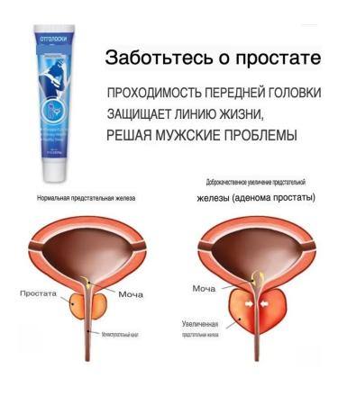 sps1 Prostatitis Cream - natural care for the prostate gland - Buy Online on GoSupps.com