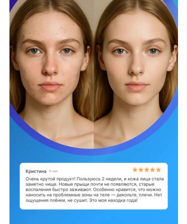 lvcos T Facial serum from acne with niacinamide - Buy Online on GoSupps.com