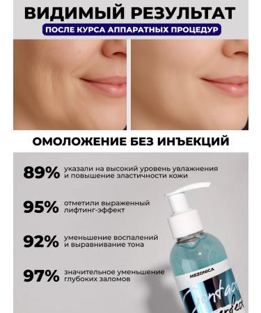 Mesonica Contact gel for RF lifting and microcurrents - Buy Online on GoSupps.com