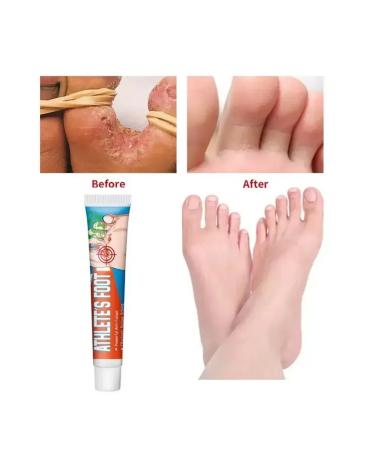 Wellness cosmetics Ointment from nail fungus and from the smell of the legs antifungal - Buy Online on GoSupps.com