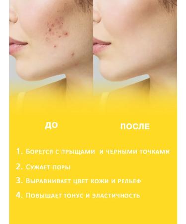 MODUM Facial serum with niacinamide 5% + cream - Buy Online on GoSupps.com