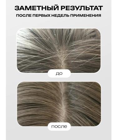 Cosmex Sonusufantic shampoo against dandruff 1000 ml - Buy Online on GoSupps.com