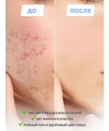 Skin 1004 MADAGASCAR Caling a serum for a person with a centella of 100 ml - Buy Online on GoSupps.com