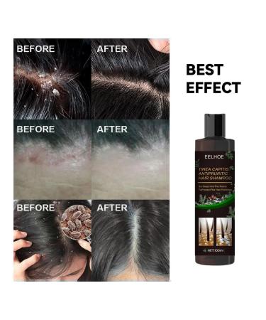 Eelhoe shampoo from lichen for people - Buy Online on GoSupps.com