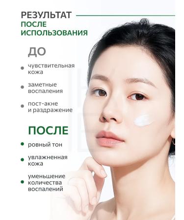 Anua Moisturizer for problem skin 30 ml - Buy Online on GoSupps.com