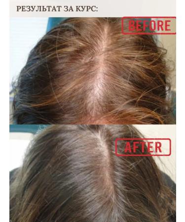 Beauty Pharma Serum for growth and against hair loss 10 ml - Buy Online on GoSupps.com