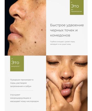 sadoer Facial mask bubble deep cleansing of black dots - Buy Online on GoSupps.com