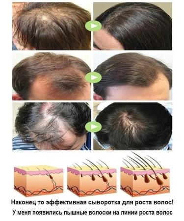 Serum against falling out and for hair growth - Buy Online on GoSupps.com