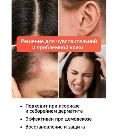 msi Hair dropping shampoo from dandruff - Buy Online on GoSupps.com