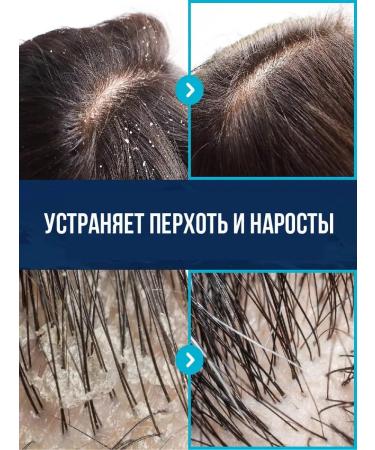 Aesthetic House Peeling shampoo Cleaning 210ml - Buy Online on GoSupps.com