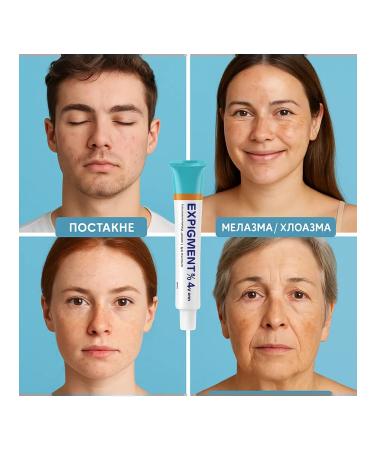 msi Body hand cream from age spots on the face from tanning - Buy Online on GoSupps.com