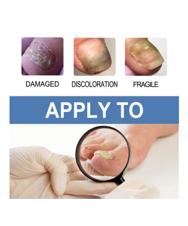 Ouhoe gel to care for nail fungus - Buy Online on GoSupps.com