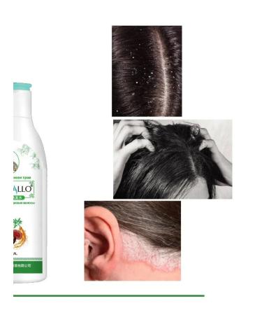 kaho Gucallo's dry peeling shampoo from psoriasis - Buy Online on GoSupps.com
