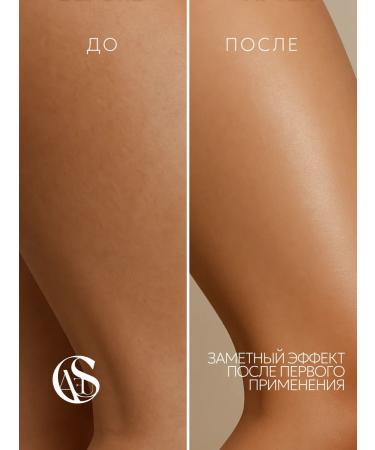 CAUSE story of care Body Cream "Vanilla & Coconut" - Buy Online on GoSupps.com