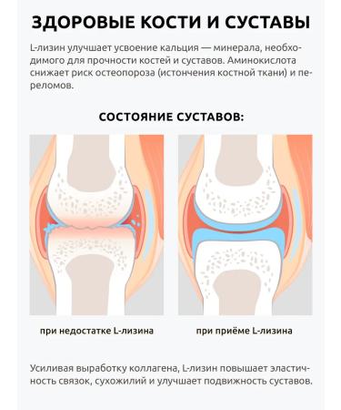 UltraBalance L-lysine 1000 mg amino acid for immunity and beauty - Buy Online on GoSupps.com