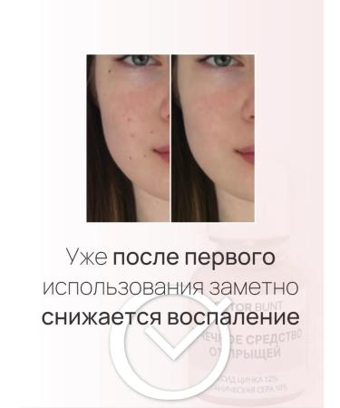 DOCTOR BUNT Spot treatment for acne - Buy Online on GoSupps.com