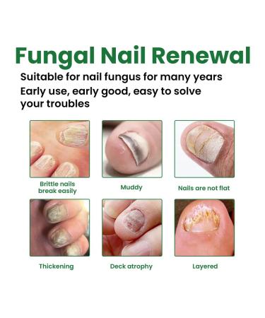 Eelhoe repair of nail fungus Nutrum solution for fungi - Buy Online on GoSupps.com