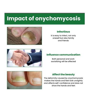 Eelhoe repair of nail fungus Nutrum solution for fungi - Buy Online on GoSupps.com